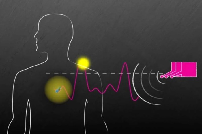 Wireless charging system juices up medical implants
