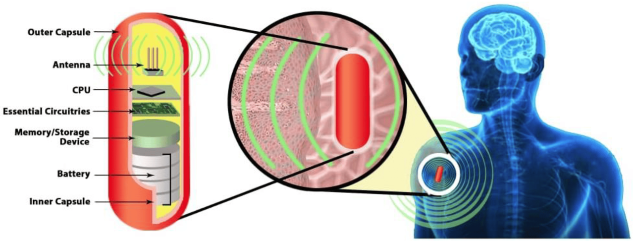 Wireless charging system juices up medical implants